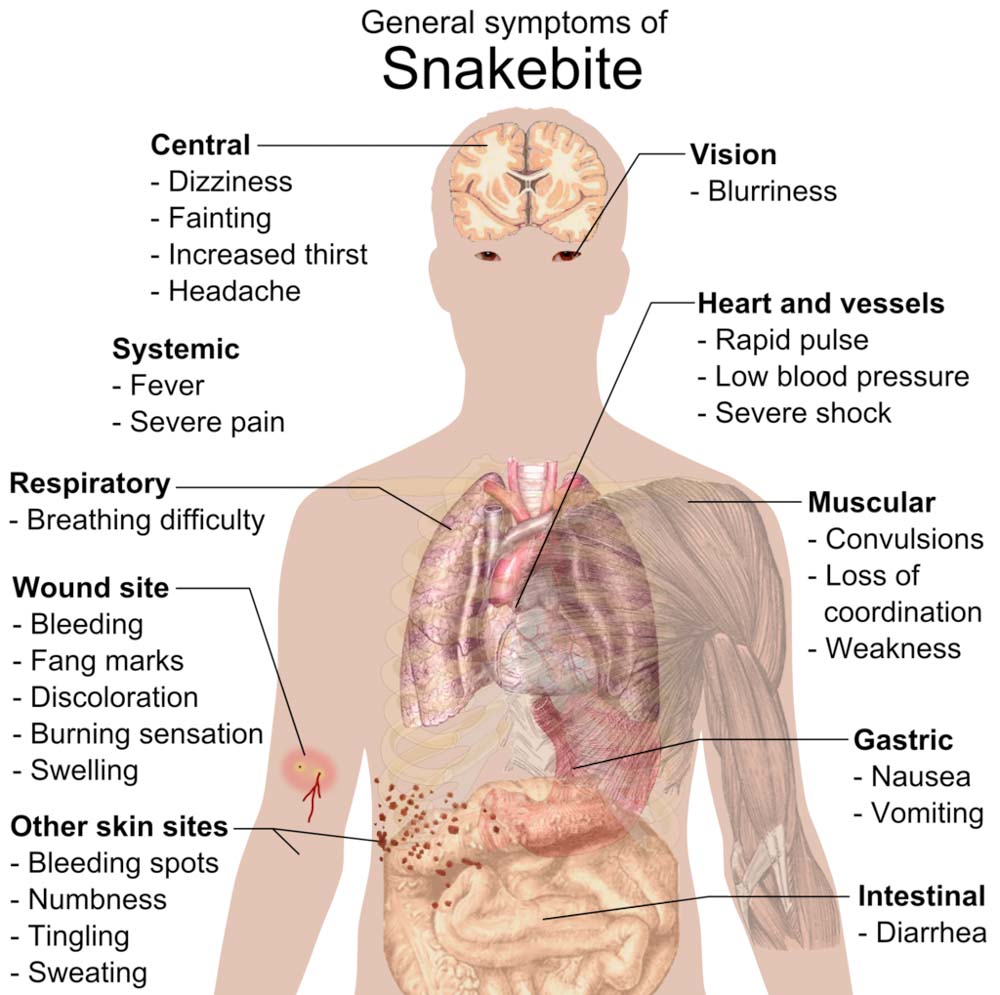 Dealing With Venomous Snakebites