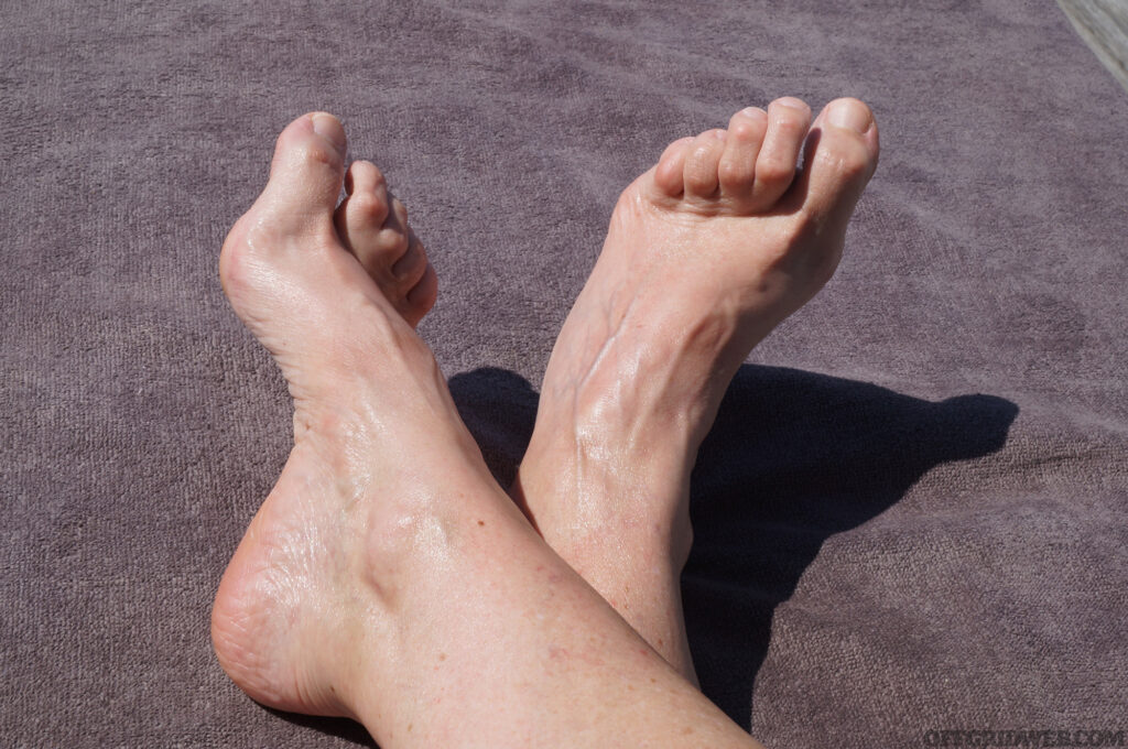 Close up photo of a pair of deform feet with a very high arch, tight tendons and bent hammertoes for an anatomy textbook