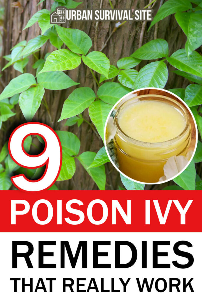 9 Poison Ivy Remedies That Really Work